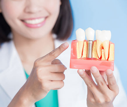 Implants | Uptowne Dental Centre